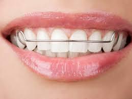Orthodontic treatment in Dubai