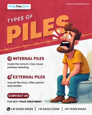  Expert Piles Doctor in Wakad for Advanced Care | Vithai Piles Clinics