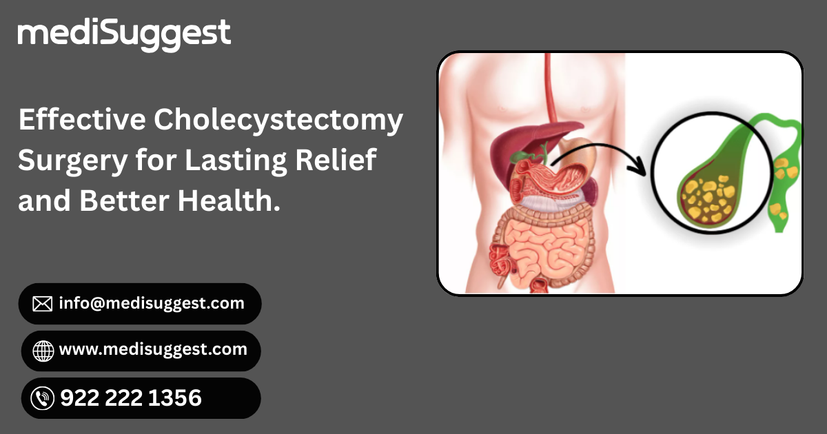 Laparoscopic Cholecystectomy Surgery near Bhayander