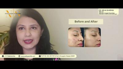Skin Doctor In Gurgaon - Dr Neha Sharma