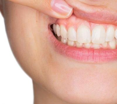 Dental Gum Treatments Near me - Other Professional Services