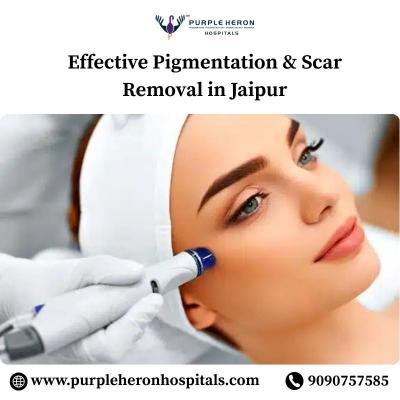 Effective Pigmentation & Scar Removal in Jaipur - Jaipur Other