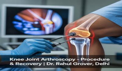 Knee joint arthroscopy - Delhi Health, Personal Trainer