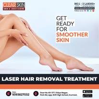 Best Advanced Laser Treatment for Birthmark Removal in India