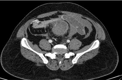 Teleradiology Services in india