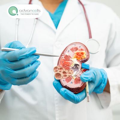 Advanced Stem Cell Treatment for CLD in India