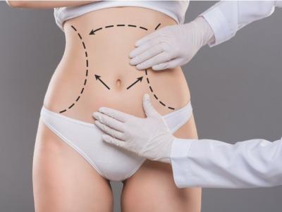 Post Liposuction Care Services Palo Alto CA