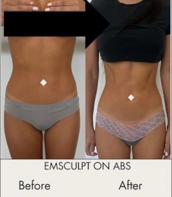 Boca Body 4 Life - Other Health, Personal Trainer