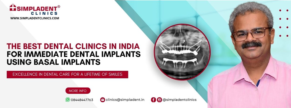 Painless Dental Implants Surgeon - Ghaziabad Health, Personal Trainer