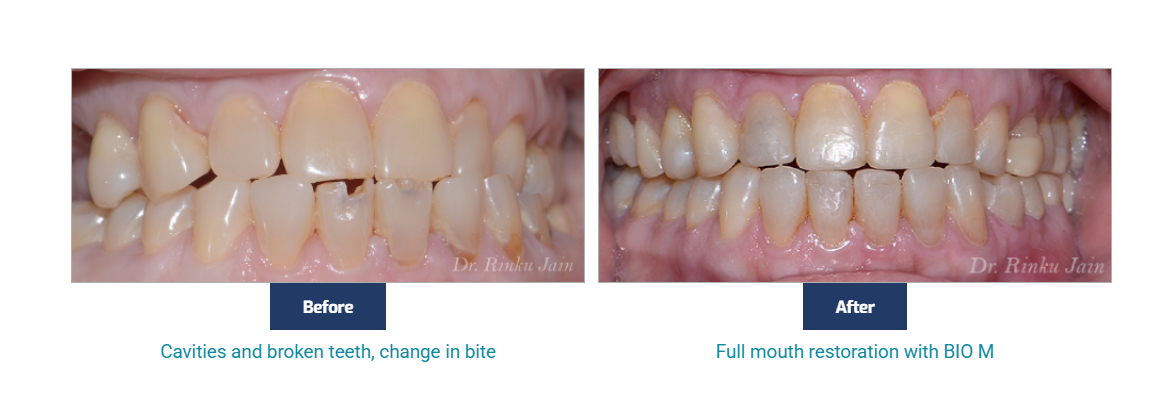 Cosmetic Dentistry Mumbai - Mumbai Health, Personal Trainer