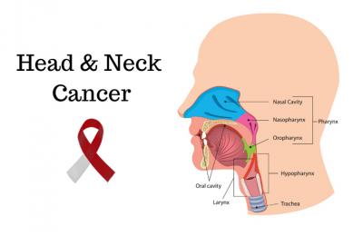 Prostate Cancer treatment in Faridabad 