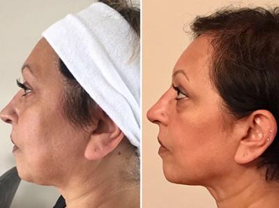 Private Dermatology Clinic in Maidenhead - Private Medical Service