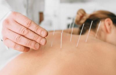Best TCM Acupuncture in Ang Mo Kio