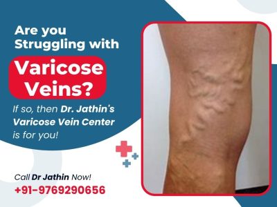 Advanced Care for Vascular and Circulatory Health