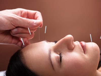 Best Acupuncture Clinic in Hollywood, FL – Drug-Free Pain Solution