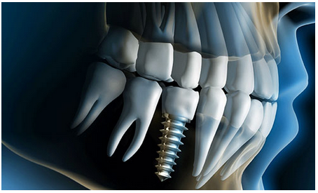 Denture in East Delhi