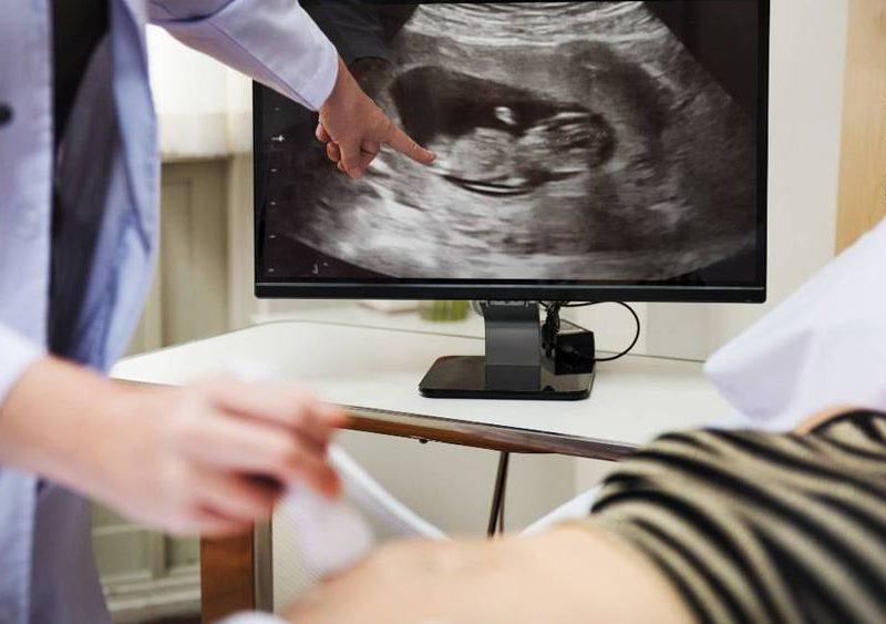 Digital X Ray Machine Cost in Mayur Vihar | RSTF