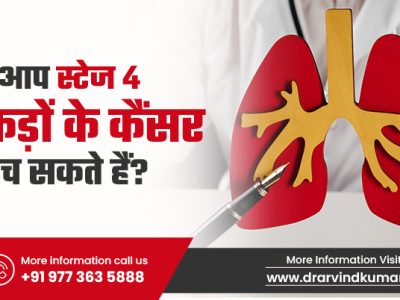 क्या स्टेज 4 फेफड़ों के कैंसर से बचाव संभव है?