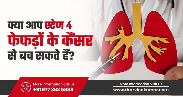 क्या स्टेज 4 फेफड़ों के कैंसर से बचाव संभव है?
