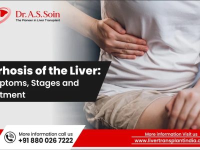 Cirrhosis of the Liver: Symptoms, Stages, and Treatment