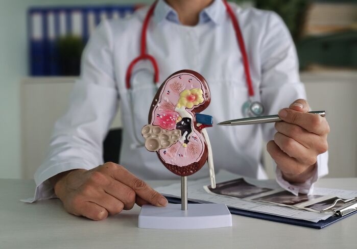 How a Kidney Stone Specialist Diagnoses and Treats Stone Pain