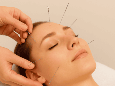 Acupuncture Specialists Dwarka