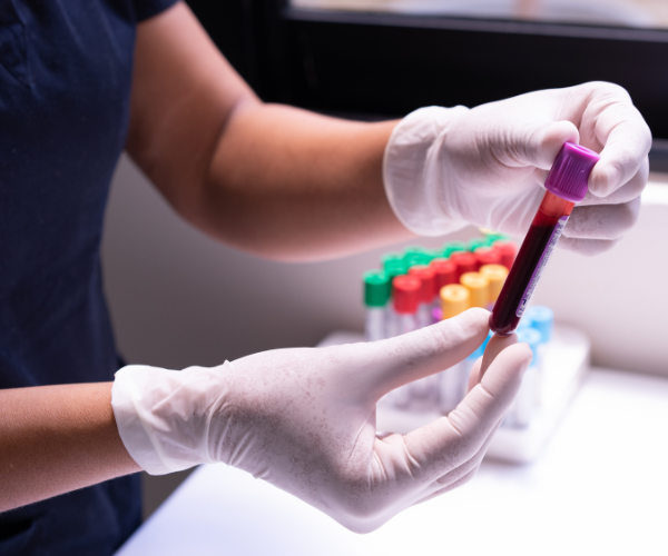 How to Become a Certified Phlebotomist in Ontario
