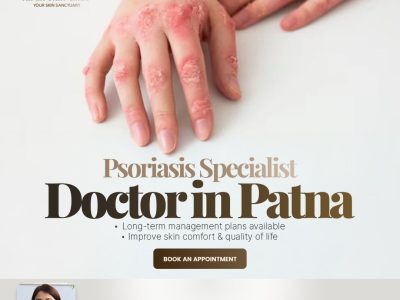 Kiran Skin Clinic - Expert Psoriasis Specialist Doctor in Patna | Long-Term Relief