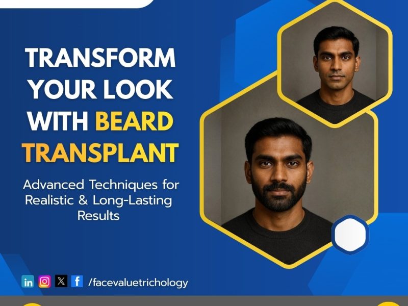 Beard Transplant in Chennai | Natural Beard Hair Transplant Clinic