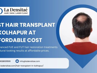 Best Hair Transplant in Kolhapur at Affordable Cost