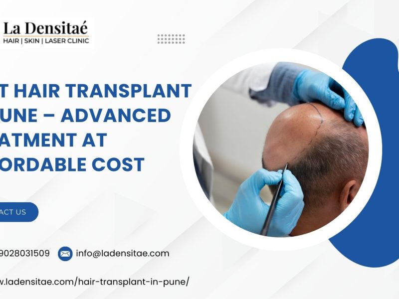 Best Hair Transplant in Pune – Advanced Treatment at Affordable Cost