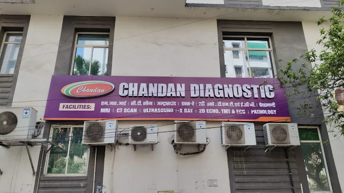 MRI cost in patna - Chandan Diagnostic Patna