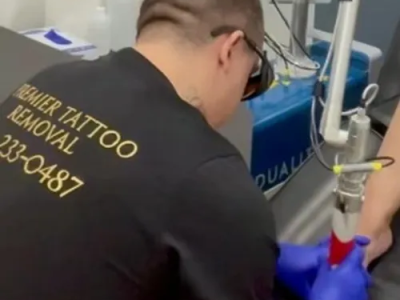 Professional Toenail Fungus Treatments in McKinney