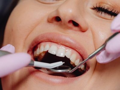Trusted Dentist in Delhi – Dentem Clinic