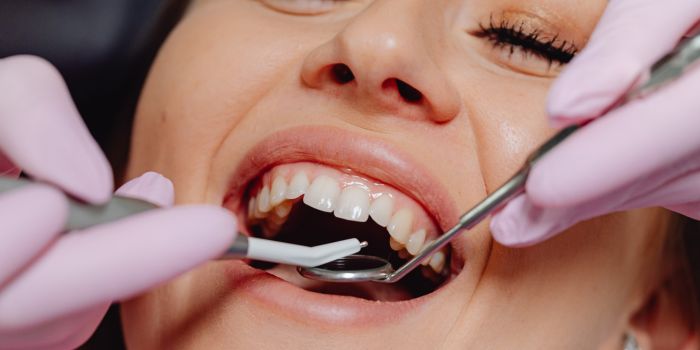 Trusted Dentist in Delhi – Dentem Clinic