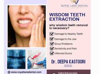 Composite Veneers in Dallas | Royal Lane Dental Center