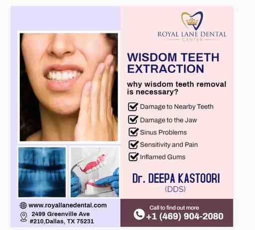 Composite Veneers in Dallas | Royal Lane Dental Center