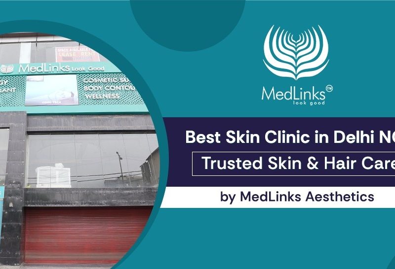 Why MedLinks Is Considered One of the Best Skin Clinics in Delhi NCR