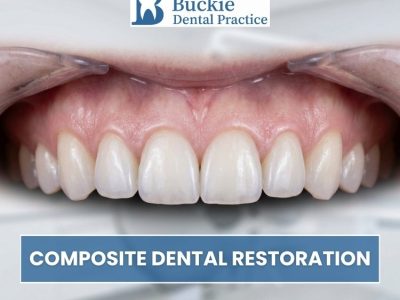 Composite Dental Restoration – Natural-Looking Repairs for a Healthier Smile