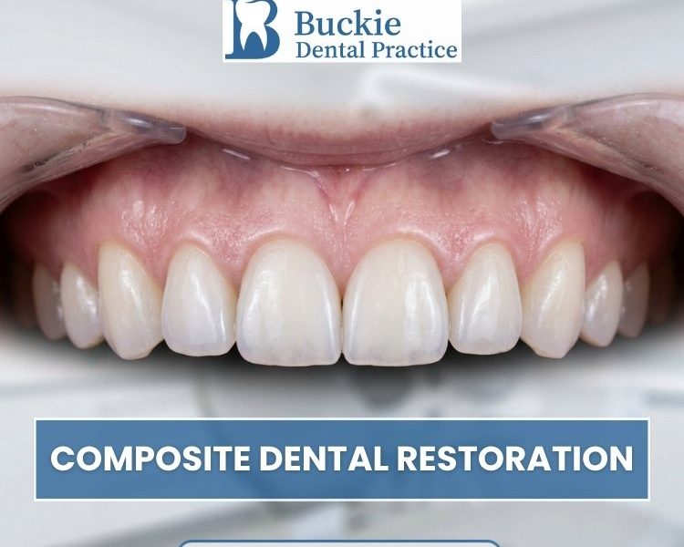 Composite Dental Restoration – Natural-Looking Repairs for a Healthier Smile