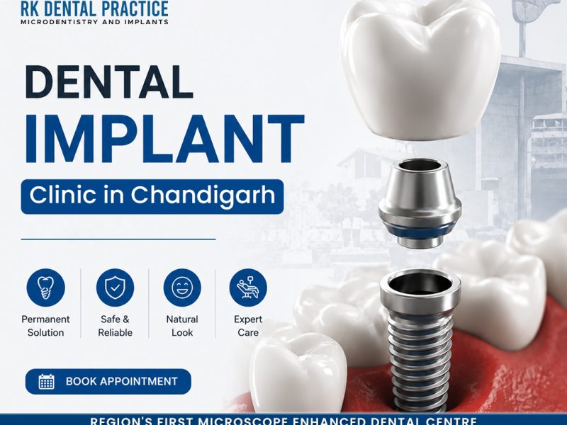 Dental Implant Clinic in Chandigarh for Advanced Tooth Replacement
