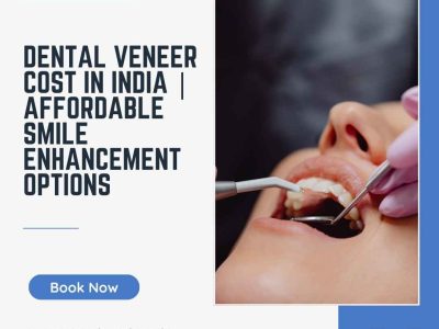 Dental Veneer Cost in India | Affordable Smile Enhancement Options