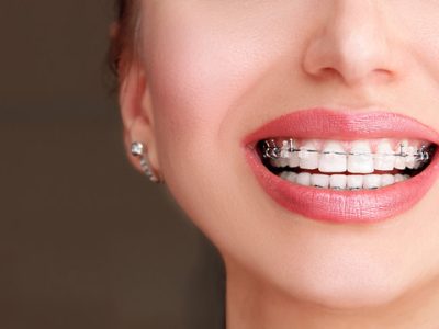 Top TMJ Disorder Treatments & Specialists in Dubai!