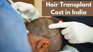 Discover Hair Transplant Cost in Delhi with Expert Consultation | MedLinks