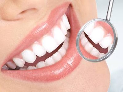 Teeth Cleaning in Phoenix , Fresh & Healthy Smiles