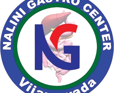 Medical Gastroenterologist in Vijayawada | Nalini Gastro Center