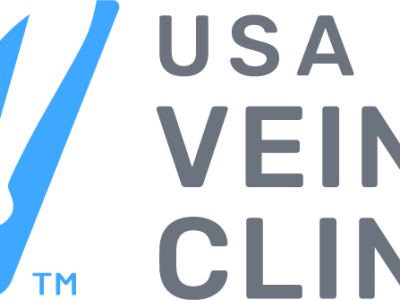 How Laser Veins Treatment Helps Eliminate Varicose Veins?