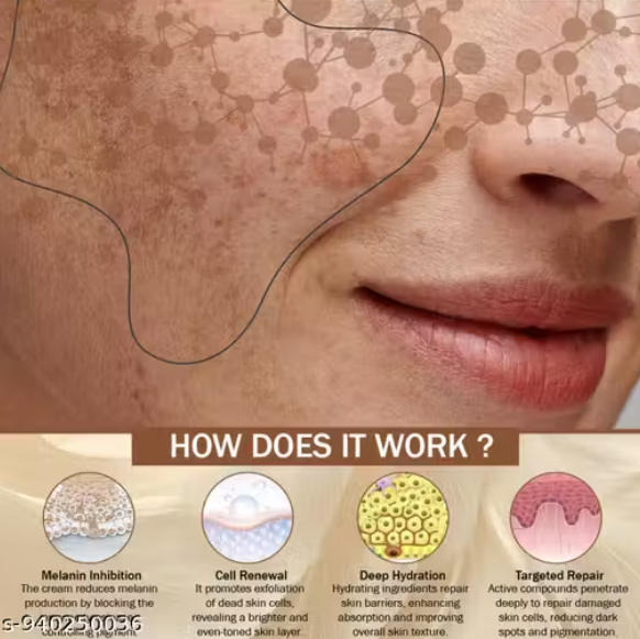 Elegantra Hyperpigmentation Cream for Dark Spots & Uneven Skin Tone 100gm | Kojic Acid & Natural Extracts | Pigmentation Removal Cream for Face | Skin Brightening & Blemish Repair Formula Pack of 1
