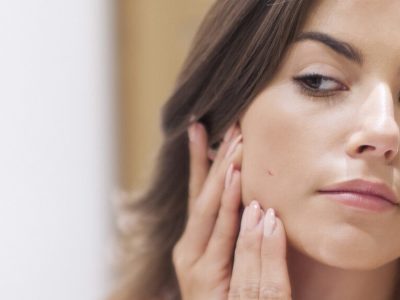 Reduce Acne Scars with Acne Scar Treatment in Gurgaon at MedLinks
