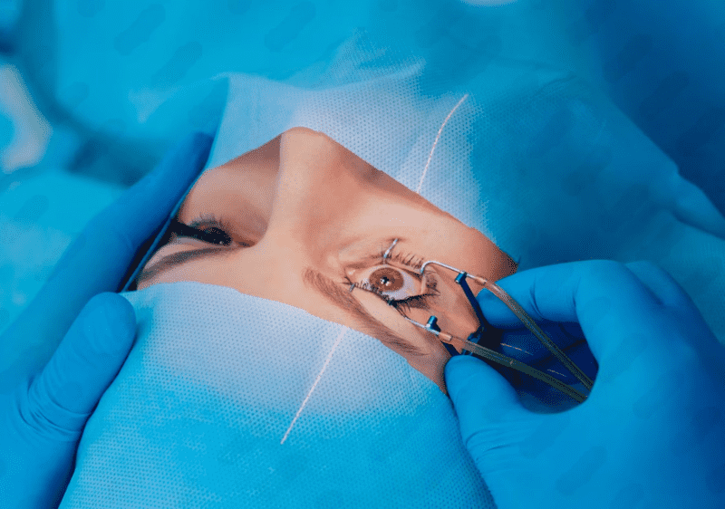 Best Standard LASIK Eye Surgery in India - Expert Eye Care